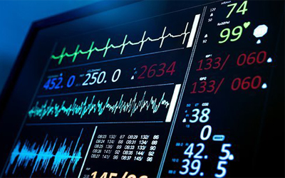 ecg in kolkata